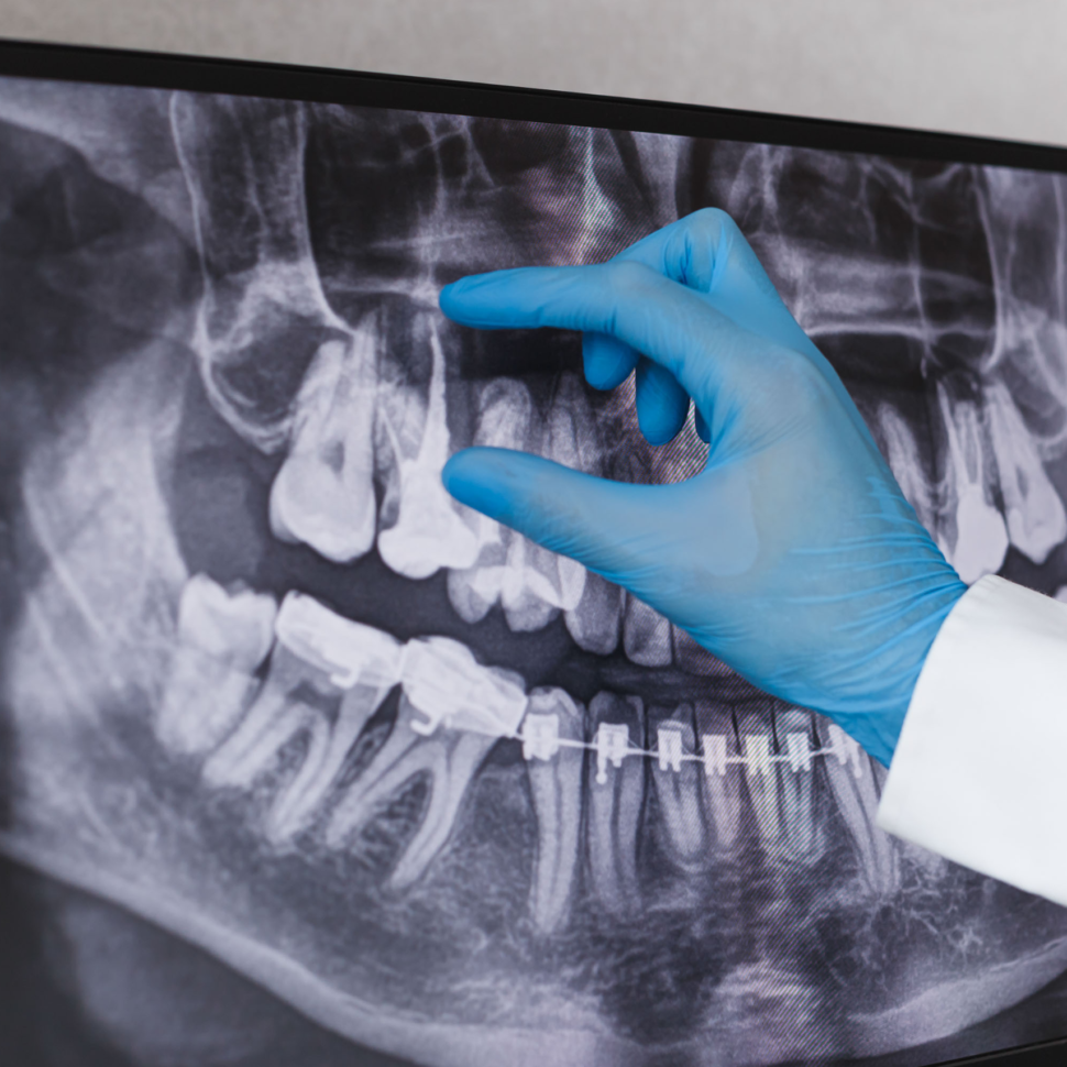 Dental Xray Cumberland Valley Endodontics